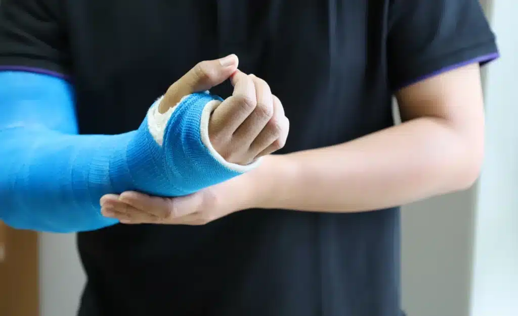 Surgical Fracture Care